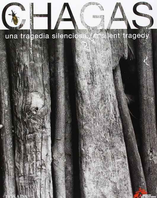 CHAGAS
