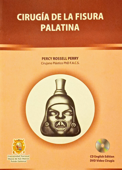 CIRUGÍA DE LA FISURA PALATINA