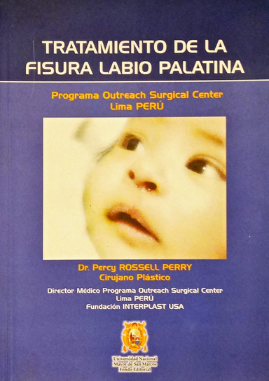 TRATAMIENTO DE LA FISURA LABIO PALATINA