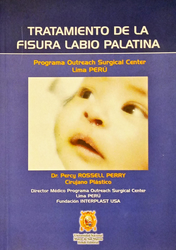 [9789972464072] TRATAMIENTO DE LA FISURA LABIO PALATINA